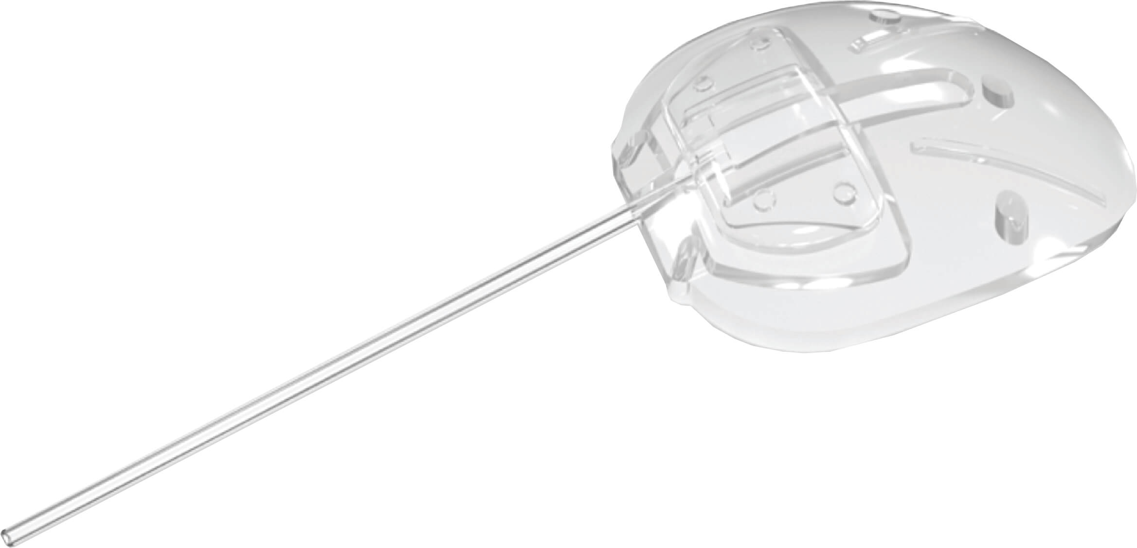 Ahmed Glaucoma Valve